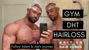 'Adam Ballinger & Joe Ballinger GYM, DHT + Hair Loss. FUE Transplant'