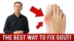 'GOUT ARTHRITIS: What Causes Gout and What Foods to Avoid for Gout'
