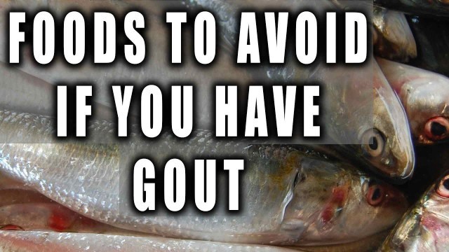 'Top 10 Foods To Avoid If You Have Gout'