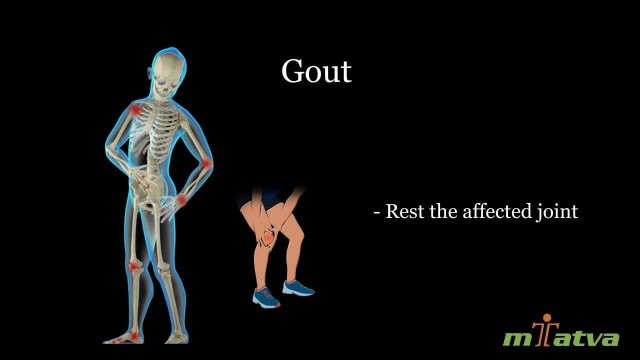 'Gout'