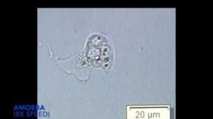 'Naked amoeba in living soil - the soil food web in action'