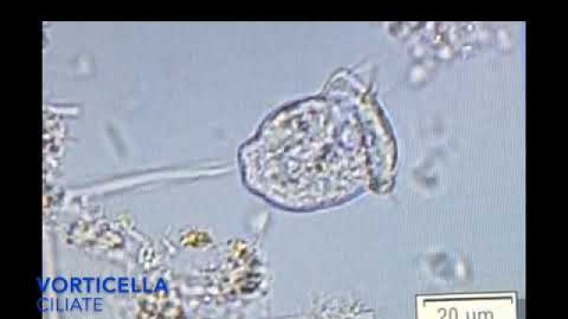 'Vorticella in living soil - the soil food web in action'