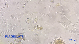 'Flagellate in living soil - the soil food web in action'