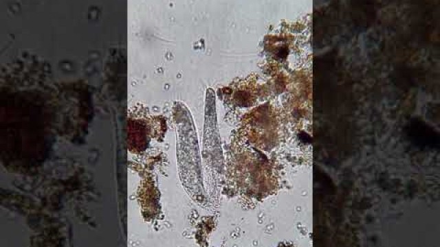 'Soil Food Web: Anaerobic - Ciliates'