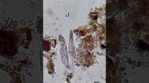 'Soil Food Web: Anaerobic - Ciliates'