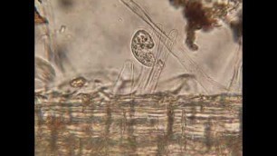 'Soil Food Web: Anaerobic~Ciliate-Genus(Colpoda)'