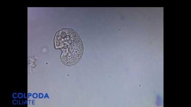 'Colpoda in living soil - the soil food web in action'