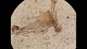 'Soil Food Web: Anaerobic: Attack of the Ciliates!'