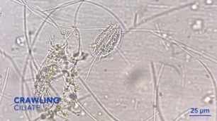 'Crawling ciliate in living soil - the soil food web in action'