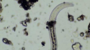 'Video Capture Of A Soil Nematode Going Into A Sleep/Dormant State. @ 200/400X 5/7/19 Soil Food Web'