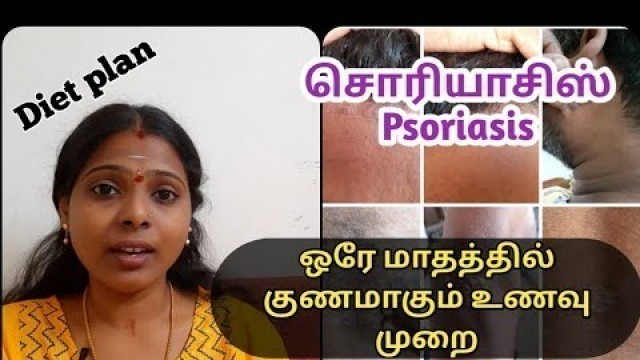 'Psoriasis diet plan | Psoriasis treatment in tamil| Psoriasis |சொரியாசிஸ் | Psoriasis cure story'